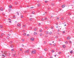 CMG1/CCDC2/IFT74 Antibody