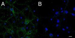 CMG1/CCDC2/IFT74 Antibody