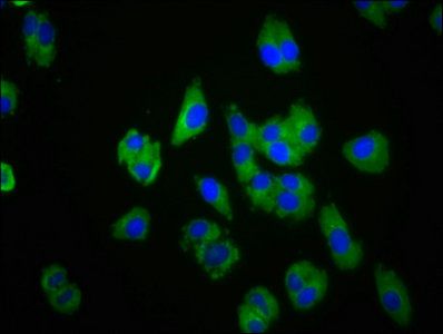 CMKLR1 Antibody