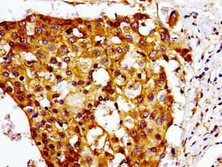 CMKLR1 Antibody