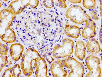CMKLR1 Antibody