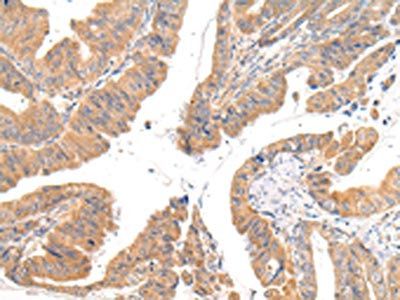 CMKLR1 Antibody