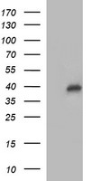CMPK1 Antibody
