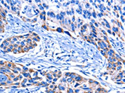 CNGA2 Antibody