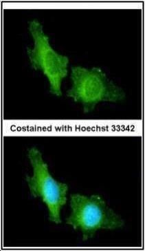 cyclic nucleotide gated channel alpha 2 Antibody