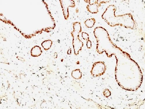 CNN1 Antibody