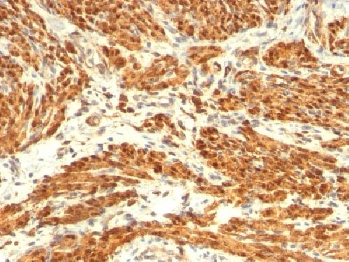 CNN1 Antibody