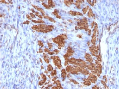 CNN1 Antibody