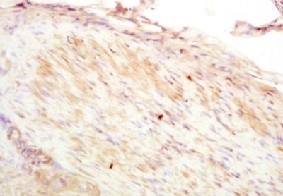 CNN2 Rabbit Polyclonal Antibody
