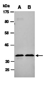 CNN2 (C) Antibody, Rabbit Polyclonal