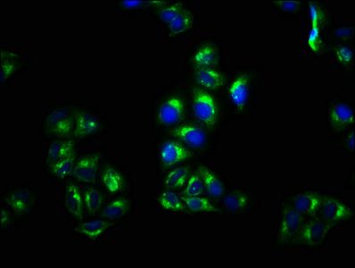 CNNM4 Antibody