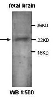 CNTF Rabbit Polyclonal Antibody