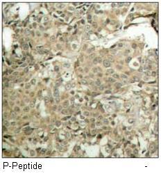 cofilin (Phospho-Ser3) Antibody