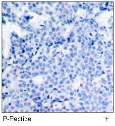 cofilin (Phospho-Ser3) Antibody