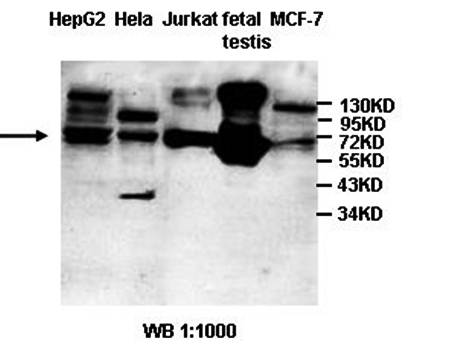 Coilin Rabbit Polyclonal Antibody