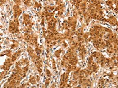 COL4A3BP Antibody