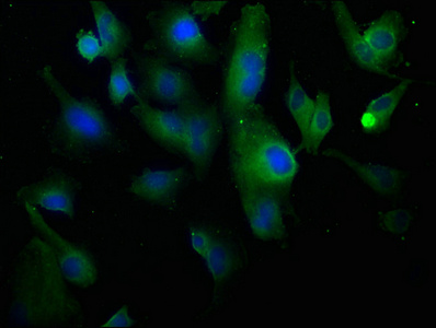 COL1A1 Antibody