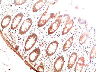 COL1A1 Antibody