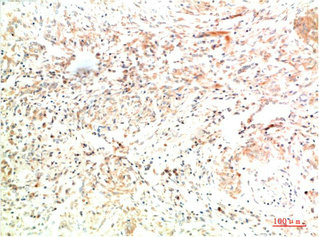 COL2A1 Antibody