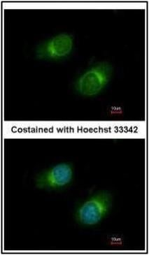 Collagen III antibody [C2C3-2], C-term