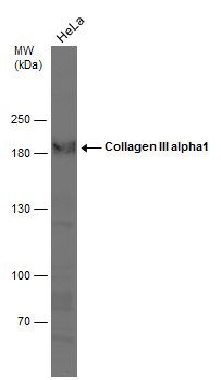 Collagen III antibody [C2C3-2], C-term