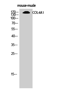 COL4A1 Antibody