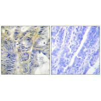 COL4A5 Antibody