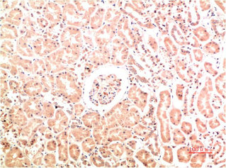 COL4A1 Antibody