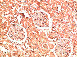 COL4A1 Antibody