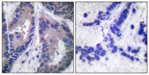 Collagen α1 XVIII Antibody