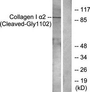 Collagen I α2 (Cleaved-Gly1102) Antibody