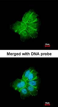 Collagen I alpha2 antibody