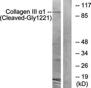 Collagen III α1 (Cleaved-Gly1221) Antibody