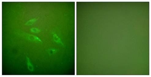 Collagen III Antibody