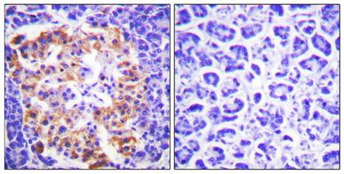 Collagen III Antibody