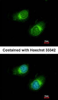 Collagen III antibody