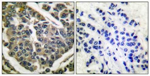 Collagen IV Antibody