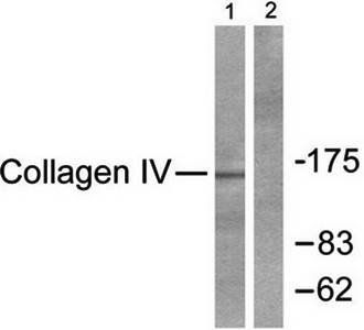 Collagen IV Antibody