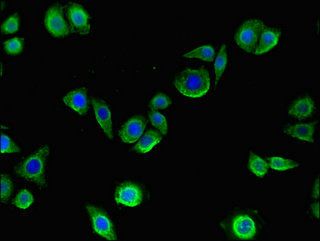 MMP13 Antibody