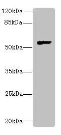 MMP13 Antibody