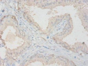 Mmp13 Antibody