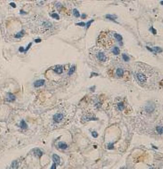 COMMD1 Rabbit Polyclonal Antibody