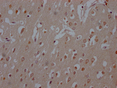 COMT Antibody