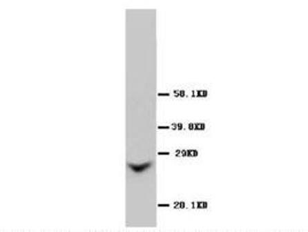 Gap junction beta-2 protein GJB2 Rabbit Polyclonal Antibody