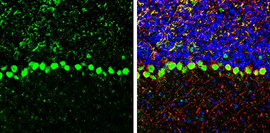 COPD Rabbit Polyclonal Antibody