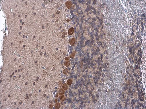 COPD Rabbit Polyclonal Antibody