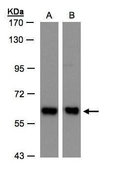 COPD Rabbit Polyclonal Antibody