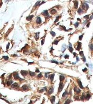 COPE Rabbit Polyclonal Antibody