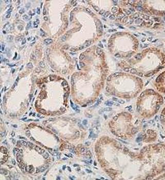COX iv Rabbit Polyclonal Antibody