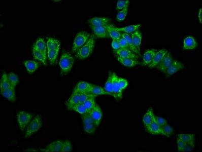 CPS1 Antibody